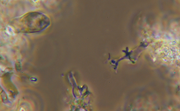 Crosta bianca da det. - foto 7006 (Crustomyces subabruptus)